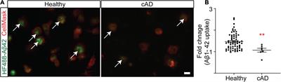 GW5074 Increases Microglial Phagocytic Activities: Potential Therapeutic Direction for Alzheimer’s Disease